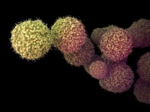 PD-1治疗失败后仍可尝试这种药