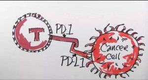 PD-1抗体用了以后部分患者可能出现“假耐药”或“假进展”？