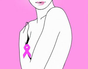 PD-1治疗三阴性乳腺癌有效性研究