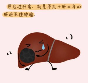 肝癌患者使用PD-1抗体须知这几点