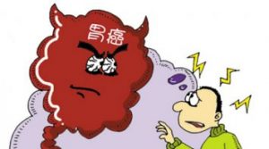 PD-1为胃癌患者带来新希望