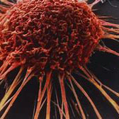 间质性肺疾病能用PD-1吗？